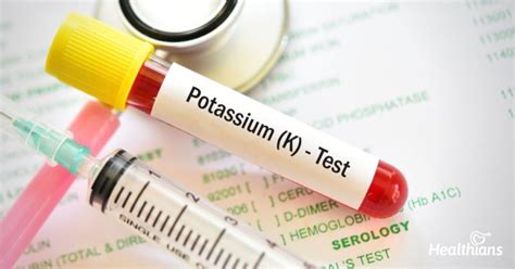 Potassium test: MedlinePlus Medical Encyclopedia